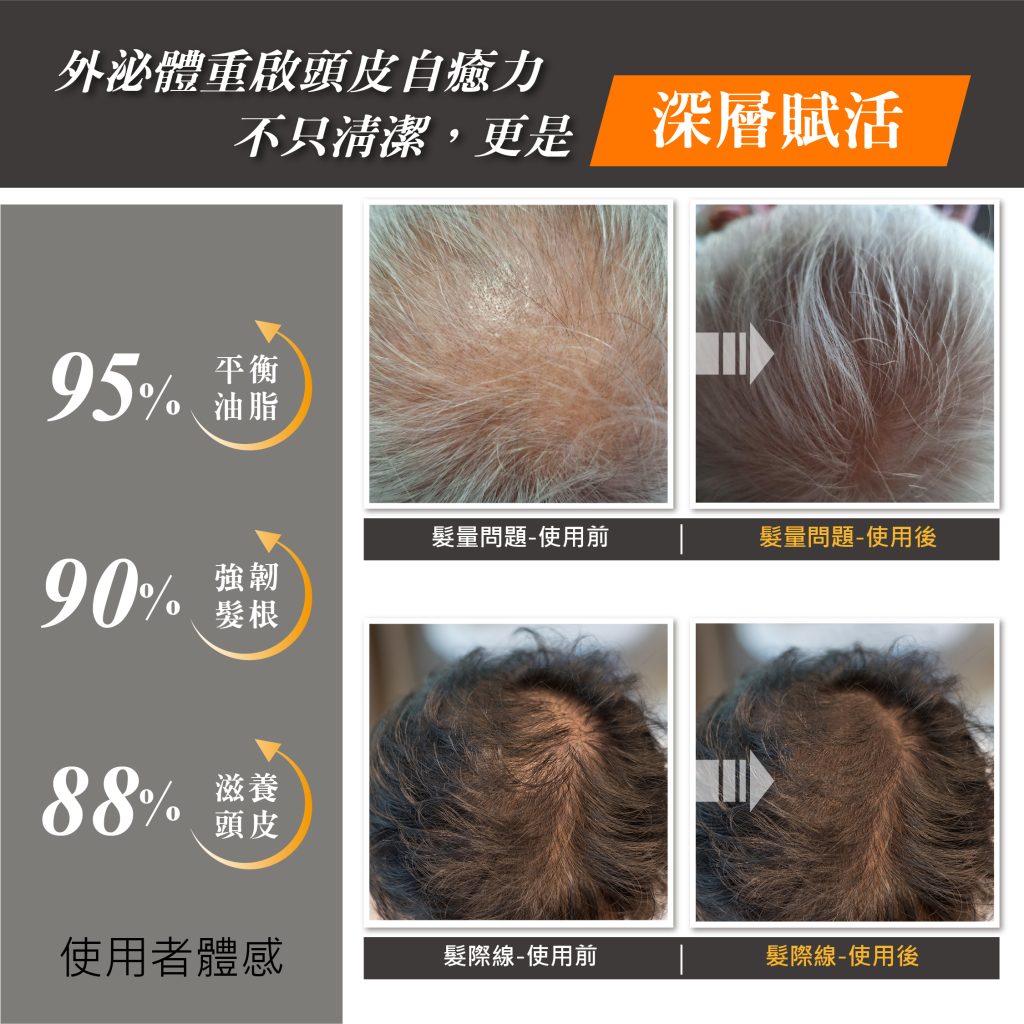 外泌體生薑養髮洗髮精